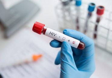 HIV Testi 